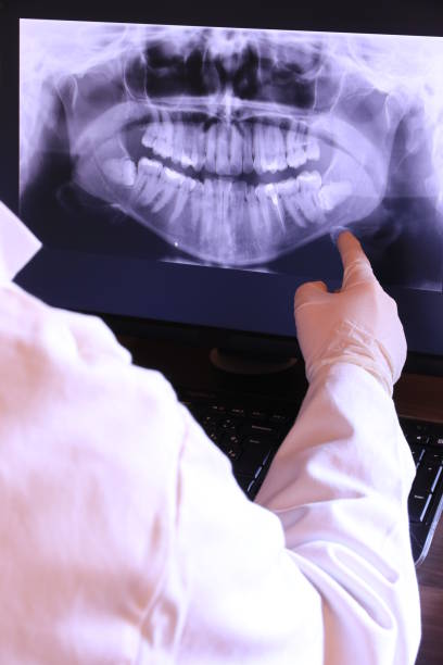 Best Broken or Cracked Tooth Emergency Dentist in Rockledge, PA